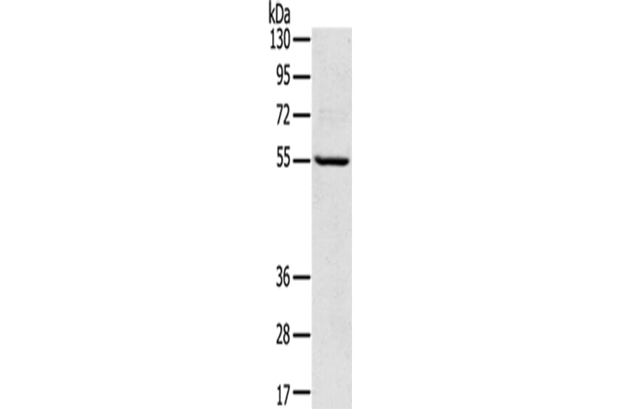TPH2 Antibody from Signalway Antibody (43424) - Antibodies.com