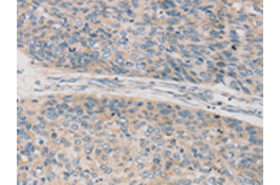 Immunohistochemistry - TPH2 Antibody from Signalway Antibody (43424) - Antibodies.com