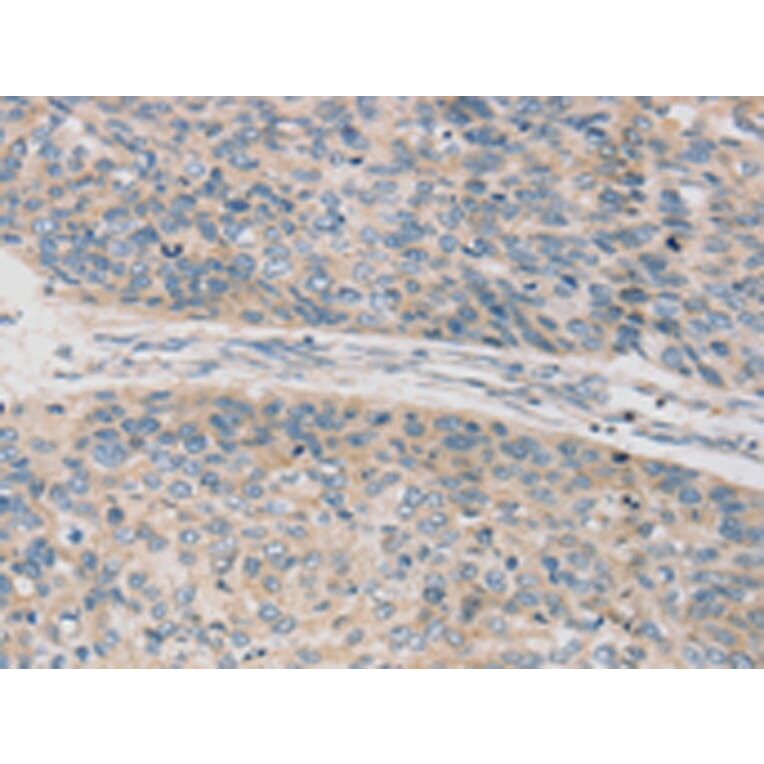 Immunohistochemistry - TPH2 Antibody from Signalway Antibody (43424) - Antibodies.com