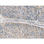 Immunohistochemistry - TPH2 Antibody from Signalway Antibody (43424) - Antibodies.com