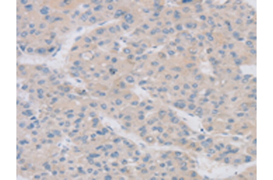 Immunohistochemistry - TPH2 Antibody from Signalway Antibody (43424) - Antibodies.com