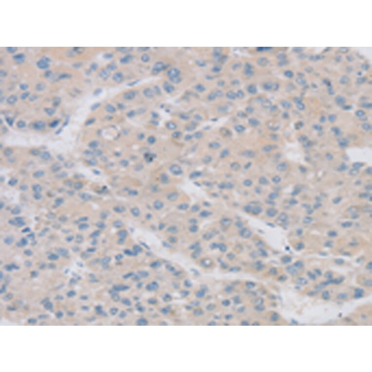 Immunohistochemistry - TPH2 Antibody from Signalway Antibody (43424) - Antibodies.com