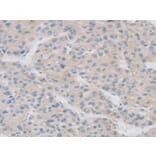 Immunohistochemistry - TPH2 Antibody from Signalway Antibody (43424) - Antibodies.com