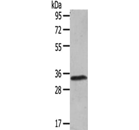 UCP3 Antibody from Signalway Antibody (43430) - Antibodies.com