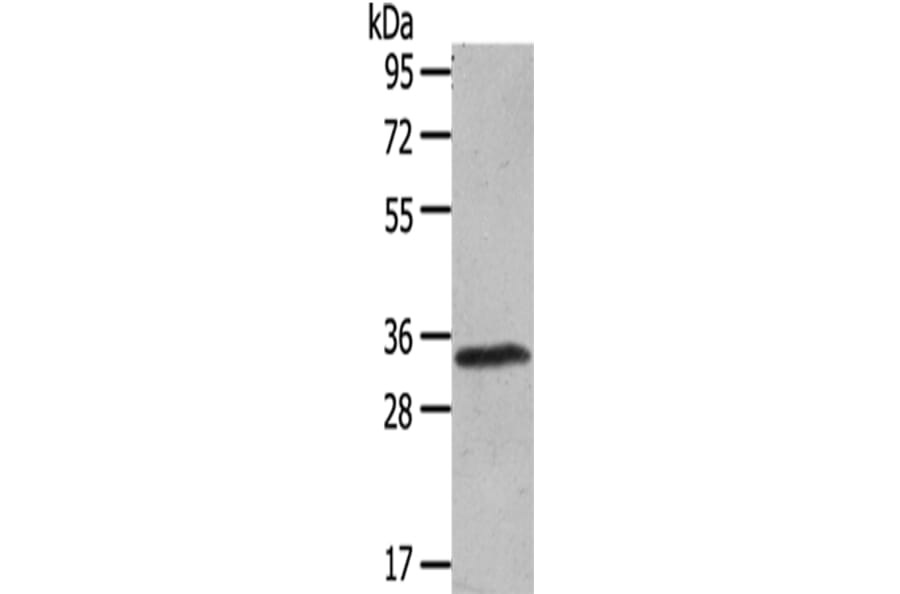 UCP3 Antibody from Signalway Antibody (43430) - Antibodies.com