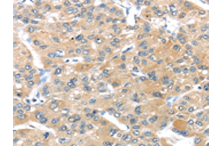 Immunohistochemistry - UCP3 Antibody from Signalway Antibody (43430) - Antibodies.com