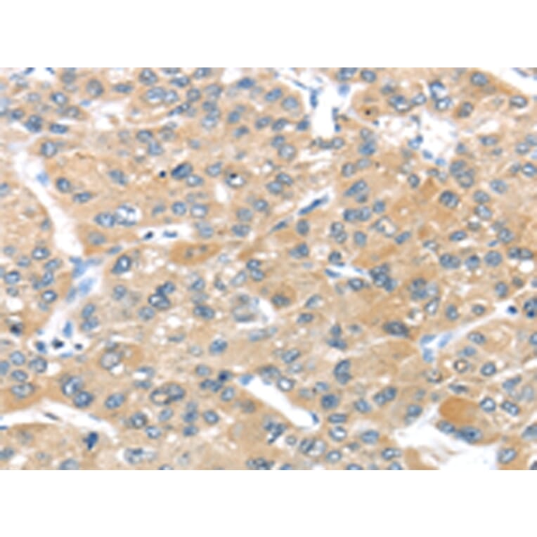 Immunohistochemistry - UCP3 Antibody from Signalway Antibody (43430) - Antibodies.com