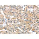 Immunohistochemistry - UCP3 Antibody from Signalway Antibody (43430) - Antibodies.com