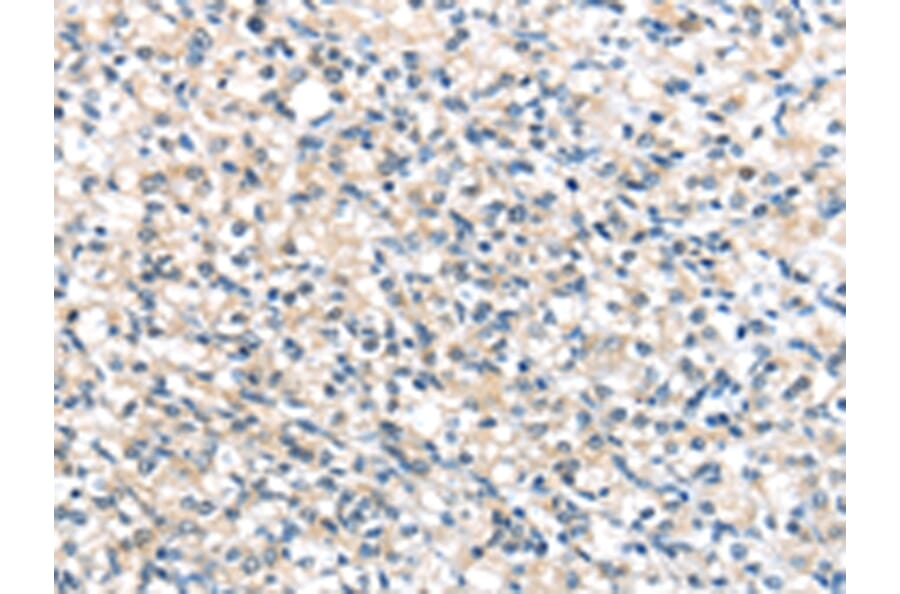 Immunohistochemistry - UCP3 Antibody from Signalway Antibody (43430) - Antibodies.com
