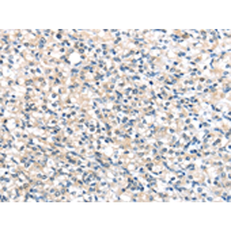 Immunohistochemistry - UCP3 Antibody from Signalway Antibody (43430) - Antibodies.com