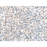 Immunohistochemistry - UCP3 Antibody from Signalway Antibody (43430) - Antibodies.com
