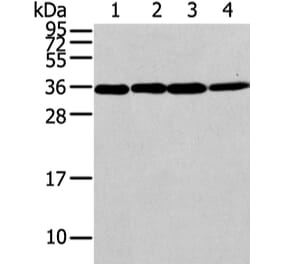 CBX7 Antibody from Signalway Antibody (43447) - Antibodies.com