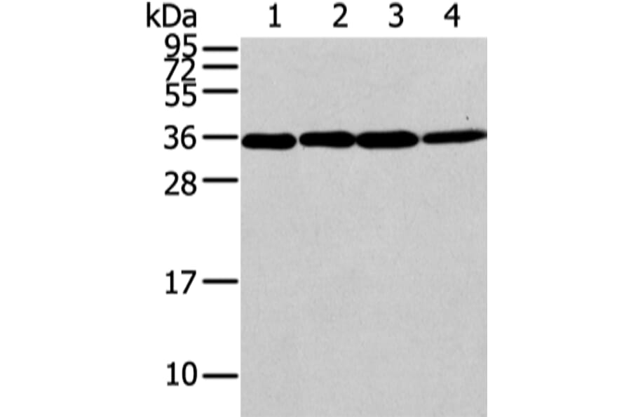 CBX7 Antibody from Signalway Antibody (43447) - Antibodies.com