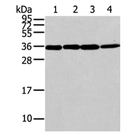 CBX7 Antibody from Signalway Antibody (43447) - Antibodies.com