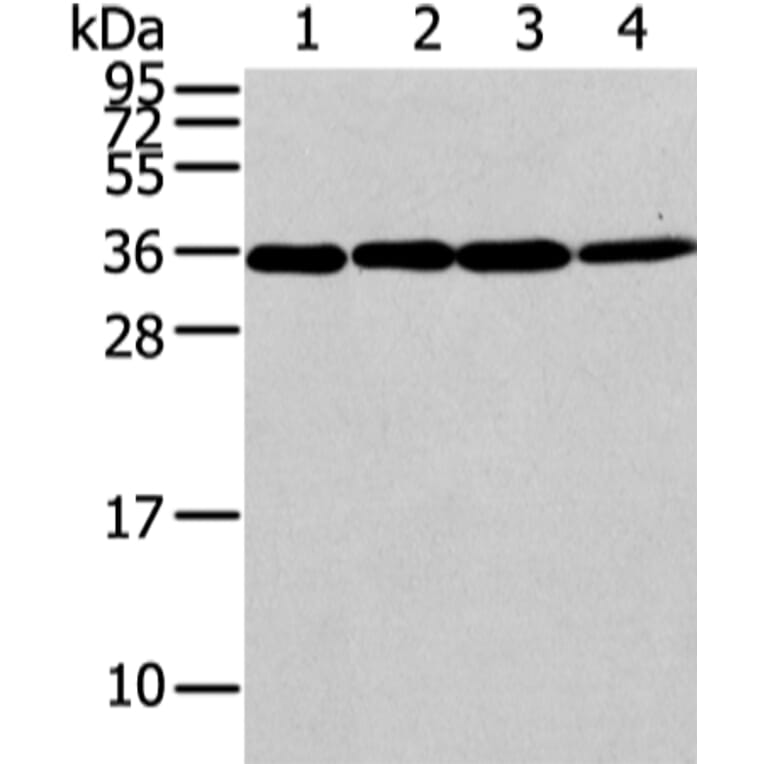 CBX7 Antibody from Signalway Antibody (43447) - Antibodies.com
