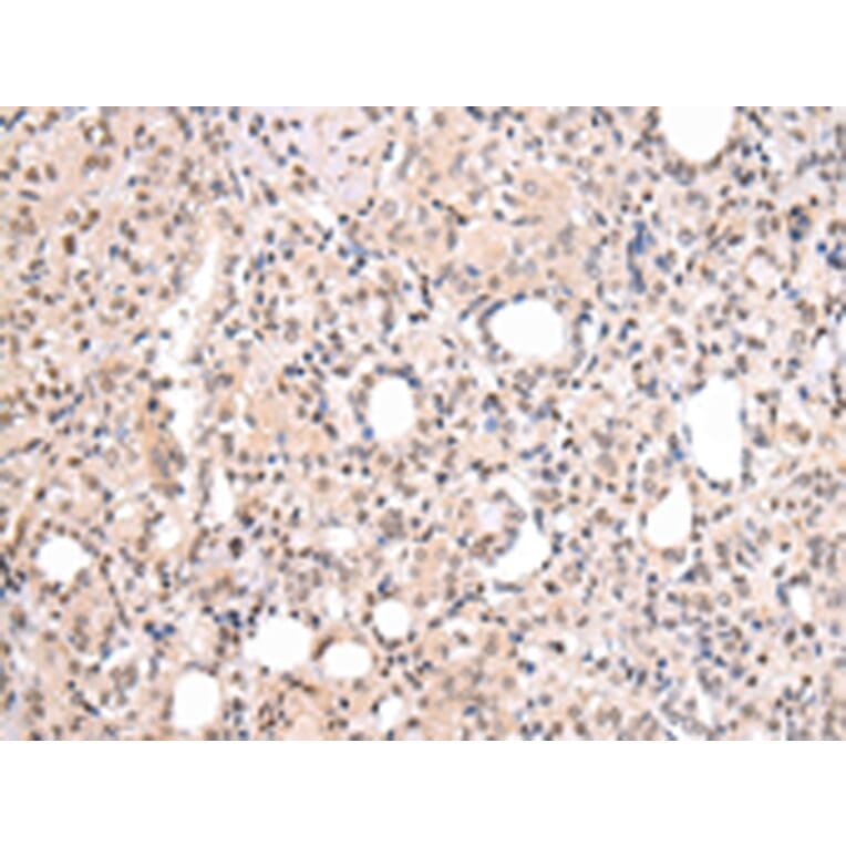 Immunohistochemistry - CBX7 Antibody from Signalway Antibody (43447) - Antibodies.com