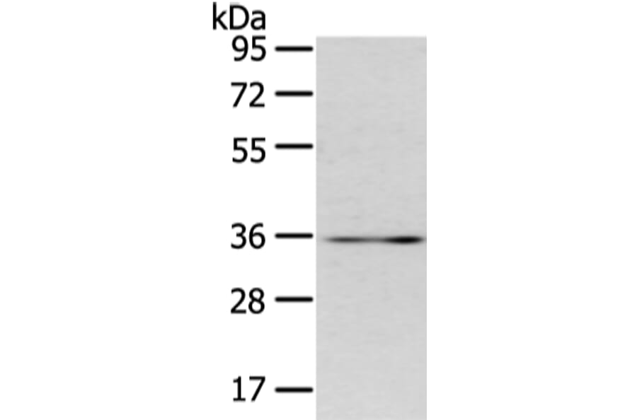 CDX2 Antibody from Signalway Antibody (43449) - Antibodies.com