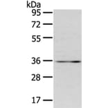 CDX2 Antibody from Signalway Antibody (43449) - Antibodies.com