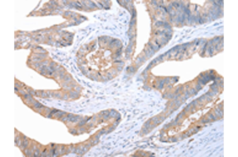 Immunohistochemistry - FASN Antibody from Signalway Antibody (43451) - Antibodies.com