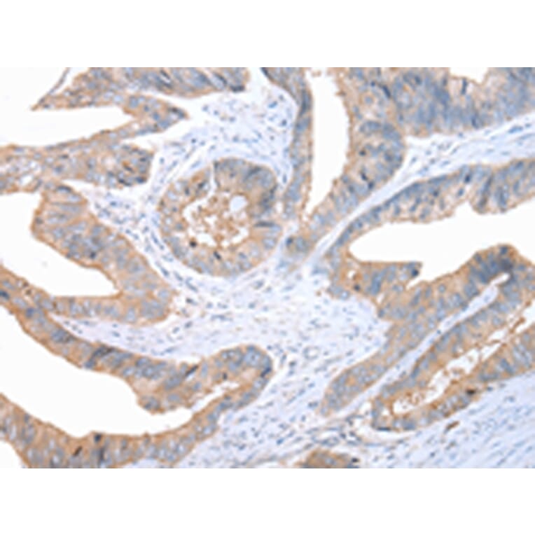 Immunohistochemistry - FASN Antibody from Signalway Antibody (43451) - Antibodies.com