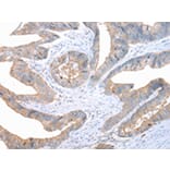 Immunohistochemistry - FASN Antibody from Signalway Antibody (43451) - Antibodies.com
