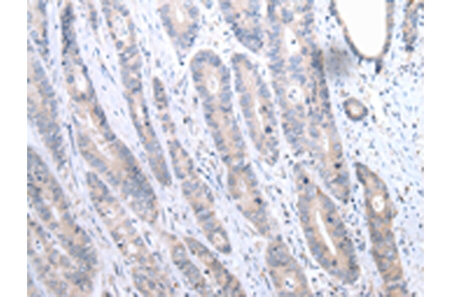 Immunohistochemistry - FASN Antibody from Signalway Antibody (43451) - Antibodies.com