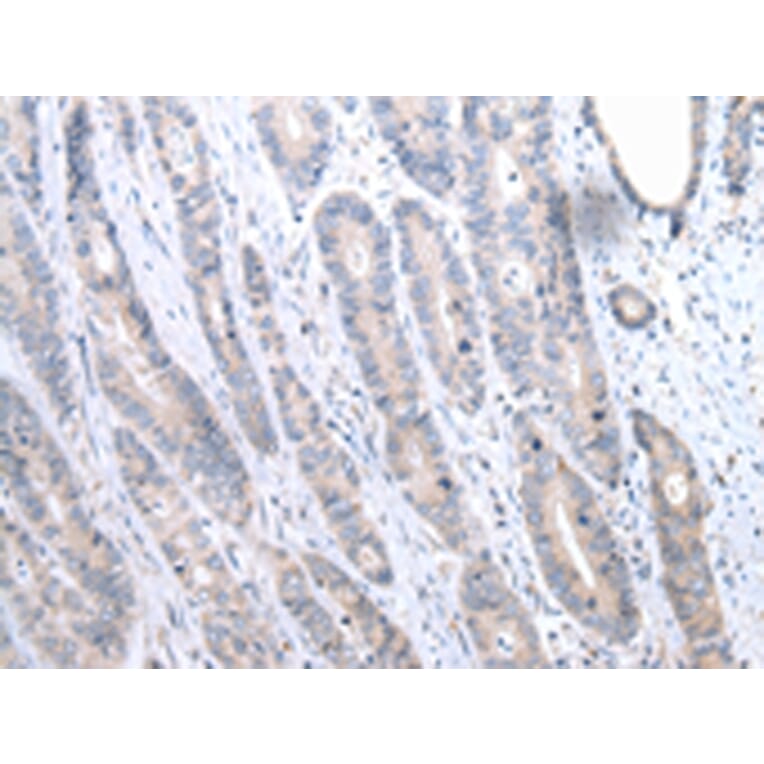 Immunohistochemistry - FASN Antibody from Signalway Antibody (43451) - Antibodies.com