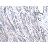 Immunohistochemistry - FASN Antibody from Signalway Antibody (43451) - Antibodies.com