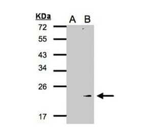 Western blot - Glutathione peroxidase 7 antibody from Signalway Antibody (22190) - Antibodies.com
