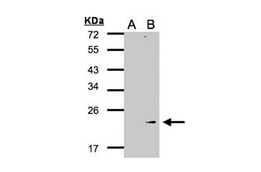 Western blot - Glutathione peroxidase 7 antibody from Signalway Antibody (22190) - Antibodies.com