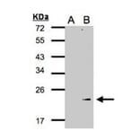Western blot - Glutathione peroxidase 7 antibody from Signalway Antibody (22190) - Antibodies.com