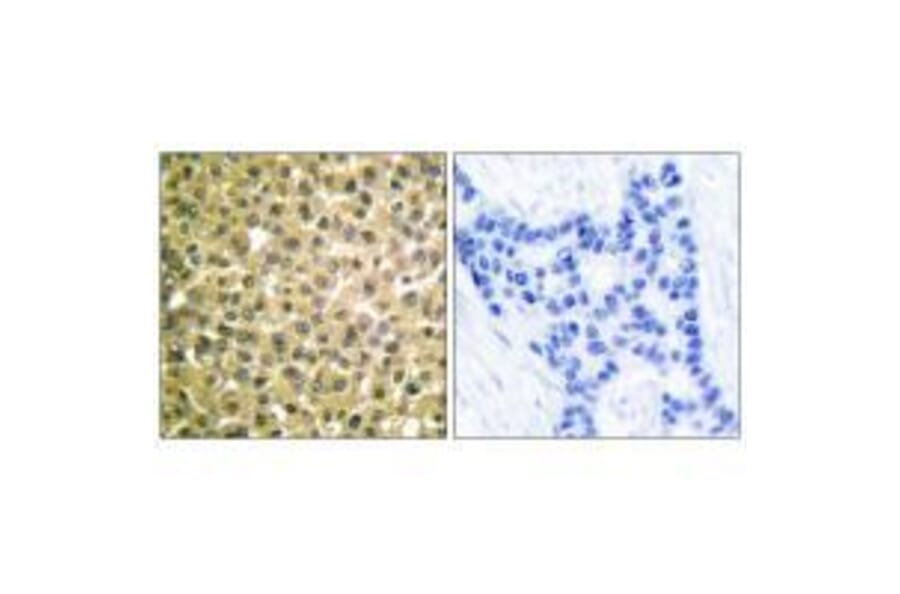 Immunohistochemistry - Retinoic Acid Receptor β Antibody from Signalway Antibody (33480) - Antibodies.com