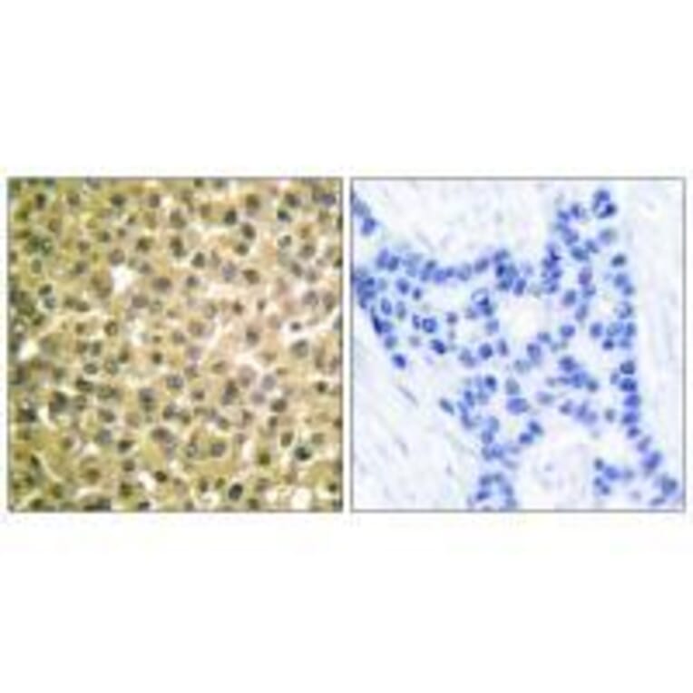 Immunohistochemistry - Retinoic Acid Receptor β Antibody from Signalway Antibody (33480) - Antibodies.com