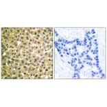 Immunohistochemistry - Retinoic Acid Receptor β Antibody from Signalway Antibody (33480) - Antibodies.com