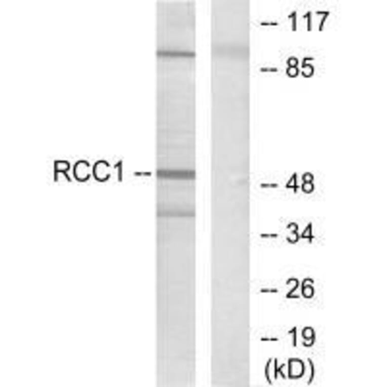 Western blot - Retinoic Acid Receptor β Antibody from Signalway Antibody (33480) - Antibodies.com