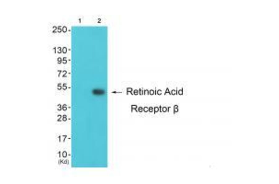 Western blot - Retinoic Acid Receptor β Antibody from Signalway Antibody (33480) - Antibodies.com