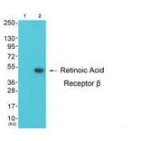 Western blot - Retinoic Acid Receptor β Antibody from Signalway Antibody (33480) - Antibodies.com