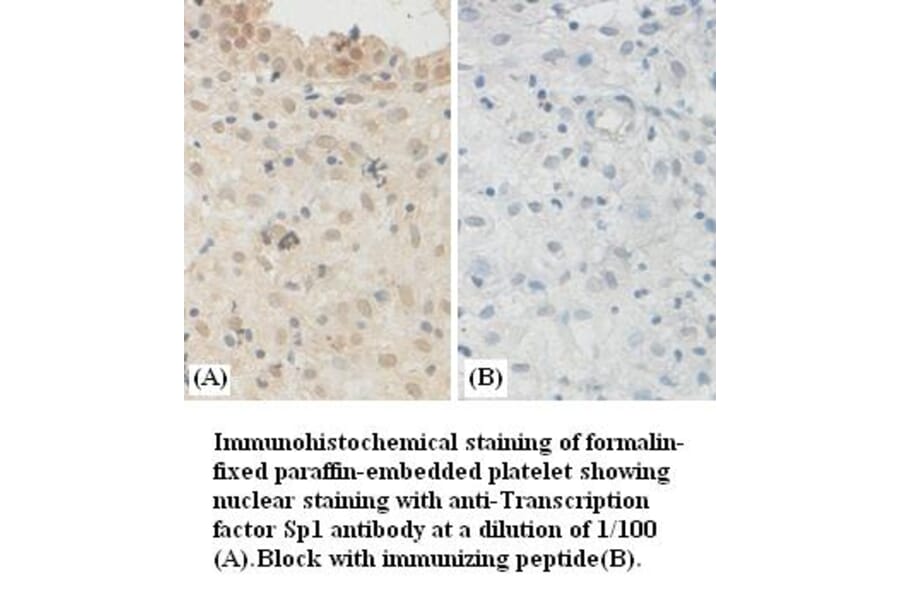 Transcription factor Sp1 Antibody from Signalway Antibody (39381) - Antibodies.com