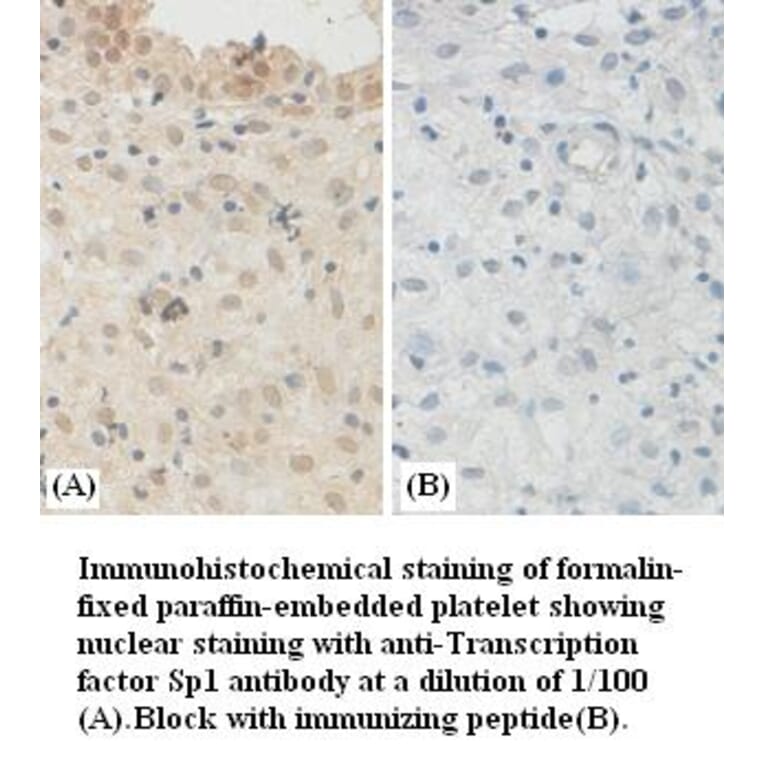 Transcription factor Sp1 Antibody from Signalway Antibody (39381) - Antibodies.com