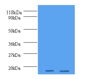 Histone H2A.J Polyclonal Antibody from Signalway Antibody (42198) - Antibodies.com
