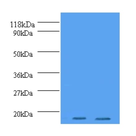 Histone H2A.J Polyclonal Antibody from Signalway Antibody (42198) - Antibodies.com