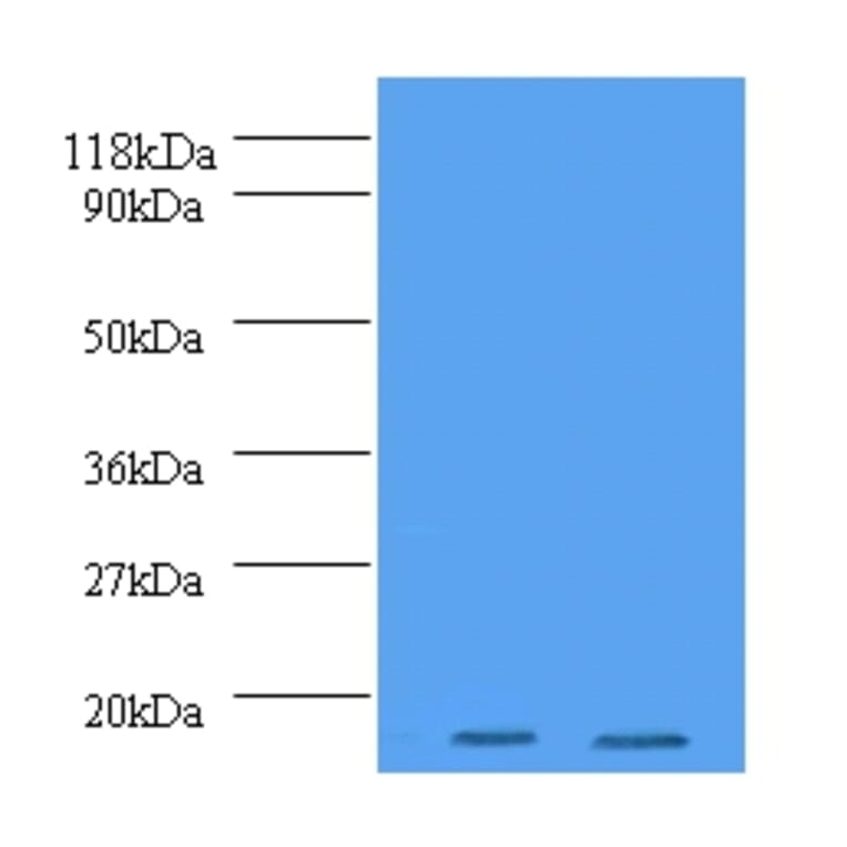 Histone H2A.J Polyclonal Antibody from Signalway Antibody (42198) - Antibodies.com