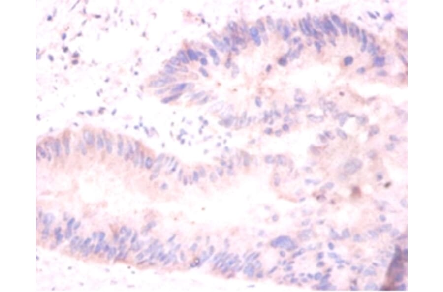 Immunohistochemistry - Histone H2A.J Polyclonal Antibody from Signalway Antibody (42198) - Antibodies.com