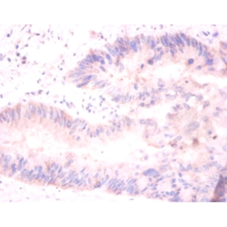 Immunohistochemistry - Histone H2A.J Polyclonal Antibody from Signalway Antibody (42198) - Antibodies.com