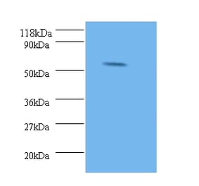 Stromelysin-2 Polyclonal Antibody from Signalway Antibody (42474) - Antibodies.com
