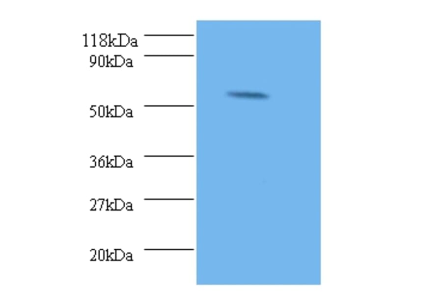 Stromelysin-2 Polyclonal Antibody from Signalway Antibody (42474) - Antibodies.com