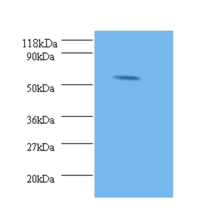 Stromelysin-2 Polyclonal Antibody from Signalway Antibody (42474) - Antibodies.com
