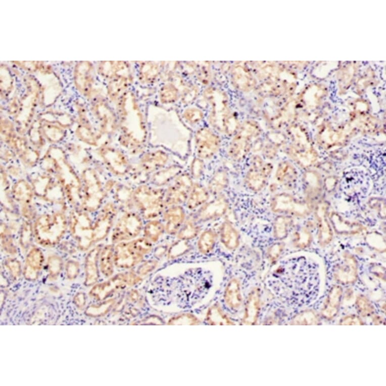 Immunohistochemistry - Stromelysin-2 Polyclonal Antibody from Signalway Antibody (42474) - Antibodies.com