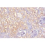 Immunohistochemistry - Stromelysin-2 Polyclonal Antibody from Signalway Antibody (42474) - Antibodies.com