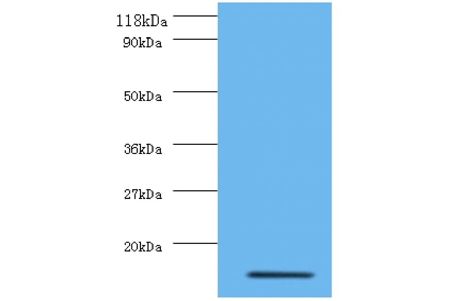 Interleukin-8 Polyclonal Antibody from Signalway Antibody (42502) - Antibodies.com